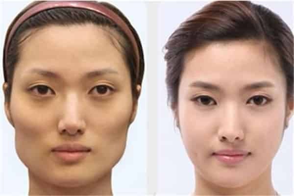 颧骨高适合剪短发吗