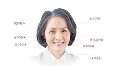 玻尿酸的副作用
