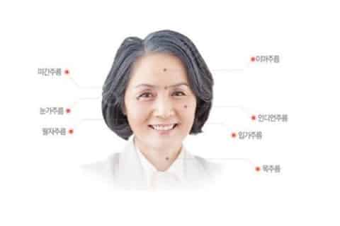 玻尿酸的副作用
