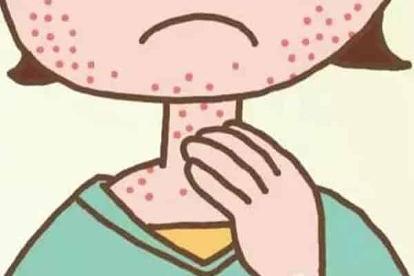 除螨皂可以和洗面奶一起用吗