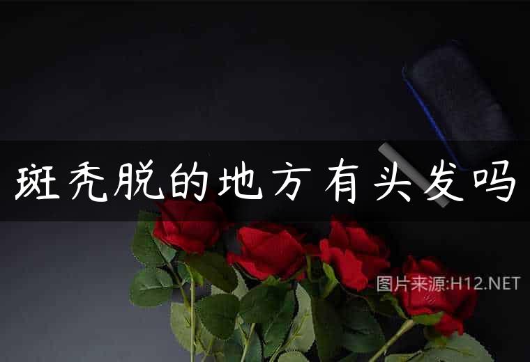 斑秃脱的地方有头发吗