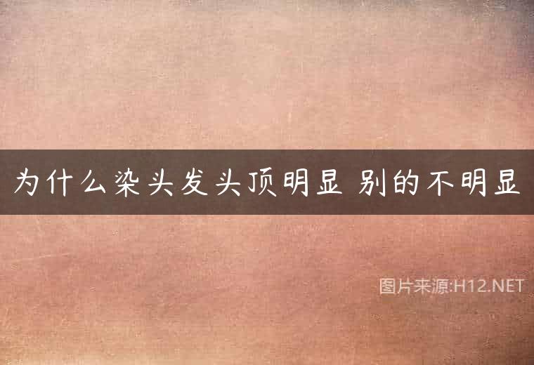 为什么染头发头顶明显 别的不明显