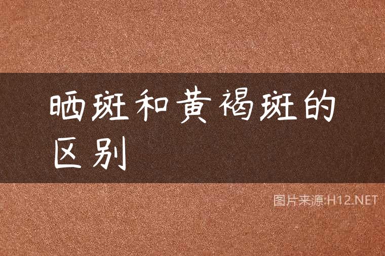 晒斑和黄褐斑的区别